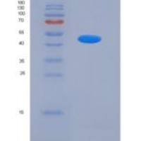 人BACE1 / ASP2重组蛋白