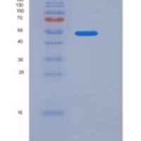 人PD-L1 / B7-H1 / CD274重组蛋白Fc tag