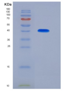 人CD247 / CD3-ZETA重组蛋白GST tag