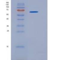 小鼠乙酰胆碱酯酶(ACHE)重组蛋白His tag