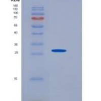 人IL21 Receptor重组蛋白His Tag