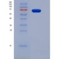 人PGA4 / Pepsinogen A重组蛋白Fc tag