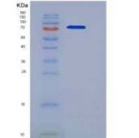 人肝配蛋白A受体4(EPHA4)重组蛋白His & Fc tag