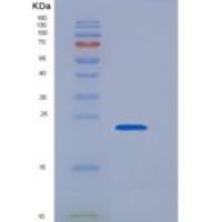 人HSP90AA1 / HSP90重组蛋白