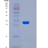 人FGFR1 / CD331重组蛋白His tag