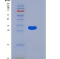 人FGFR1 / CD331重组蛋白His tag