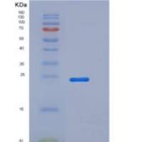 小鼠B7-DC / PD-L2 / CD273重组蛋白His tag