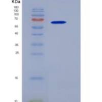 人IL-1R9 / IL1RAPL2重组蛋白Fc tag