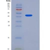 人LRRTM4重组蛋白His tag