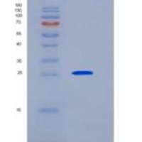 人UCHL1 / PGP9.5重组蛋白His tag