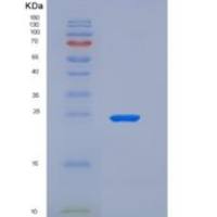 大鼠白介素20受体β(IL20Rb)重组蛋白His tag