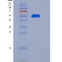 人纤连蛋白亮氨酸丰富跨膜蛋白1(FLRT1)重组蛋白His tag