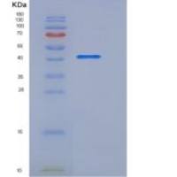 人TPST1重组蛋白His tag