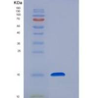 人FABP2 / I-FABP重组蛋白His tag