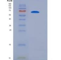 小鼠SIRP alpha / CD172a重组蛋白Fc tag