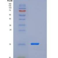 人Cystatin 7 / CST7重组蛋白