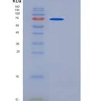 人TLR4 / CD284重组蛋白His tag