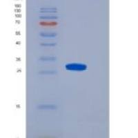 大鼠CD86分子(CD86)重组蛋白His Tag