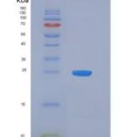 小鼠NGFR重组蛋白His Tag