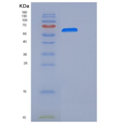 人NCAM重组蛋白ECD, His Tag