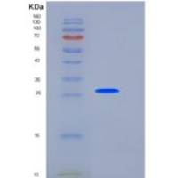 人Coagulation Factor III / Tissue Factor / CD142重组蛋白His tag