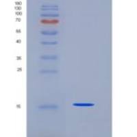 人半胱氨酸蛋白酶抑制剂1(CST1)重组蛋白His tag