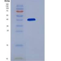 小鼠CD99L2 / MIC2L1重组蛋白Fc tag