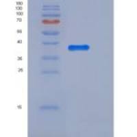 大鼠ALK-1 / ACVRL1重组蛋白His & Fc tag