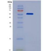 小鼠c-kit / CD117重组蛋白His tag