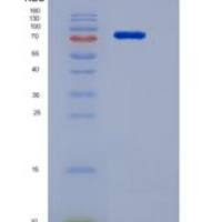 人VEGFR1 / FLT-1重组蛋白His tag