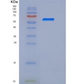 人间皮素(MSLN)重组蛋白aa 296-580, Fc tag