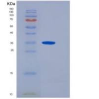 人白介素17受体A(IL17RA)重组蛋白His Tag