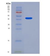 人LRRTM4重组蛋白His tag