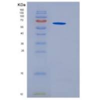 小鼠GFRA3 / GFR-alpha-3重组蛋白Fc tag