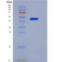 小鼠KLRB1F / NKR-P1F重组蛋白Fc tag