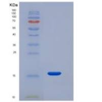 人IGJ /免疫球蛋白J链重组蛋白His tag