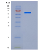 人间皮素(MSLN)重组蛋白aa 296-580, Fc t