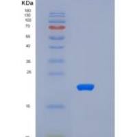 小鼠TNFRSF1A重组蛋白His Tag