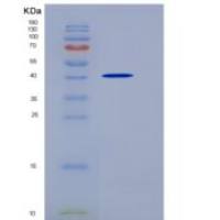 人PGA4 /胃蛋白酶原A重组蛋白His tag