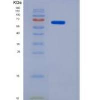 人PCSK1 / NEC1重组蛋白His tag