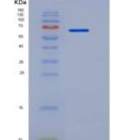 人k钙粘蛋白（K Cadherin）重组蛋白His Tag