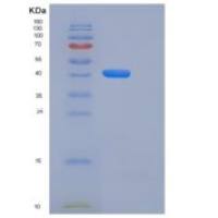 小鼠卷曲同源物10(FZD10)重组蛋白Fc tag