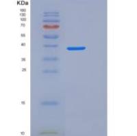 小鼠S100钙结合蛋白B(S100B)重组蛋白Fc tag