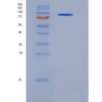 人软骨寡聚基质蛋白(COMP)重组蛋白His tag