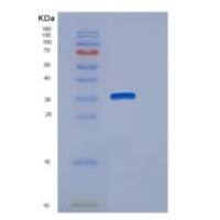 人SULT1E1 / ST1E1重组蛋白His tag