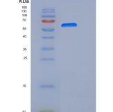 人NCAM重组蛋白ECD, His Tag