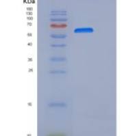 人NCAM重组蛋白ECD, His Tag