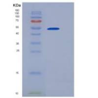 大鼠E-Selectin / CD62e / SELE重组蛋白His tag