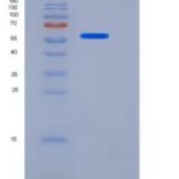 人Cochlin / COCH重组蛋白His tag