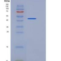 人ENTPD5重组蛋白His tag